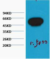 β-Tubulin Monoclonal Antibody