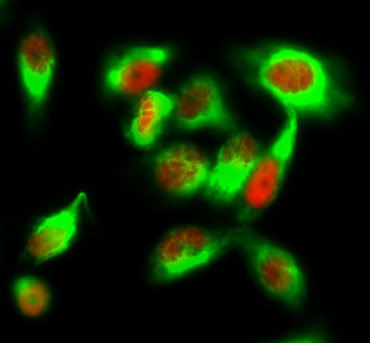 β-tubulin Monoclonal Antibody(M7)