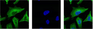β-tubulin Monoclonal Antibody(M7)