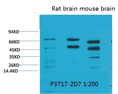 Phosphoserine Monoclonal Antibody(5B12)