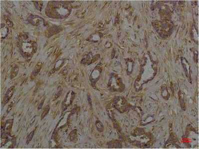 Phosphoserine Monoclonal Antibody(5B12)