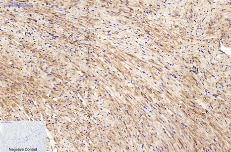 β-tubulin (HRP Conjugated) Monoclonal Antibody(5G3)