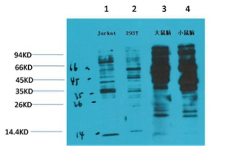 Phosphotyrosine Monoclonal Antibody(2C1)