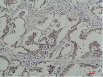 Phosphotyrosine Monoclonal Antibody(2C1)