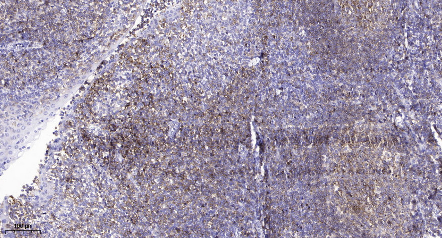 Claudin-2 Mouse Monoclonal Antibody(8H11)