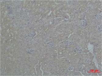 ZBTB45 Polyclonal Antibody