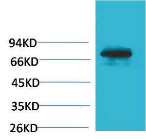 TF Polyclonal Antibody