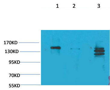 SLC12A4 Polyclonal Antibody
