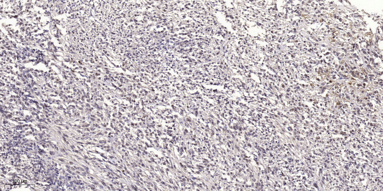 NBR1 Rabbit Polyclonal Antibody