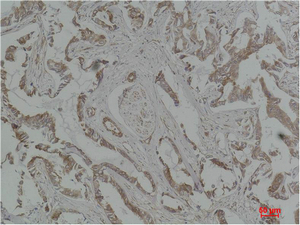 MEK-5 Polyclonal Antibody