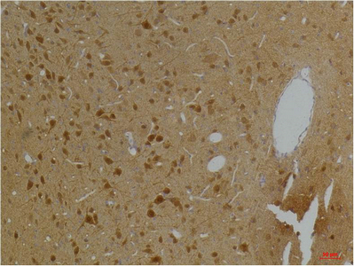 Kv10.2 Polyclonal Antibody