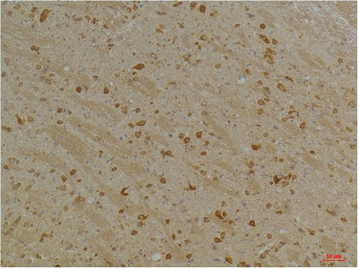 Kv10.2 Polyclonal Antibody
