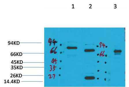 KCNN2 (SK2) Polyclonal Antibody