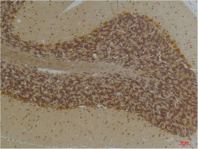 KCNN2 (SK2) Polyclonal Antibody