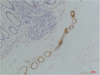 GRIK2 (GluR6) Polyclonal Antibody