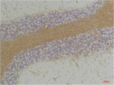 GABA A Receptor α2 Polyclonal Antibody