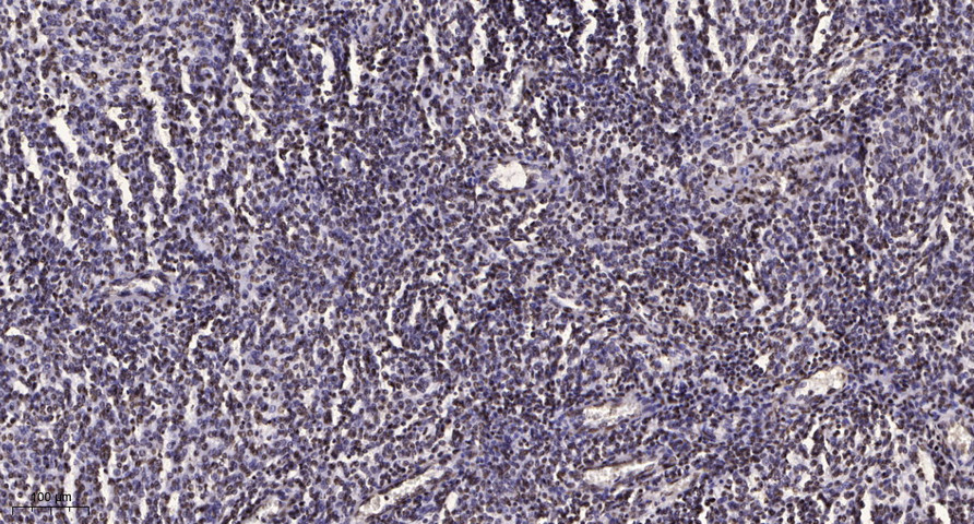 ERK1 Rabbit Polyclonal Antibody