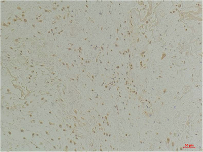 CLIC1 Polyclonal Antibody