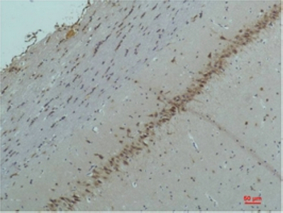 CaVα2δ2 Polyclonal Antibody