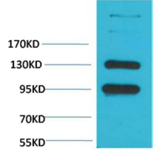 CaVα2δ1 Polyclonal Antibody