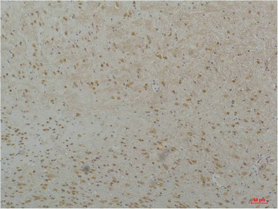 Cav3.2 Polyclonal Antibody