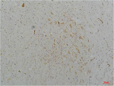 Cav2.2 Polyclonal Antibody