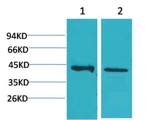 CALHM1 Polyclonal Antibody