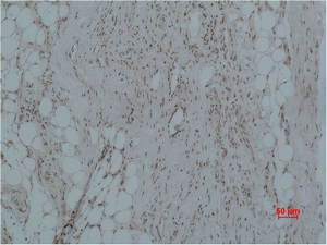 CALHM1 Polyclonal Antibody