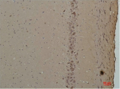 CABP Polyclonal Antibody