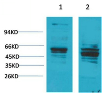 Bombesin Receptor 2 Polyclonal Antibody