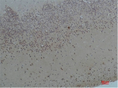 Bombesin Receptor 2 Polyclonal Antibody