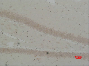 BEST2 Polyclonal Antibody