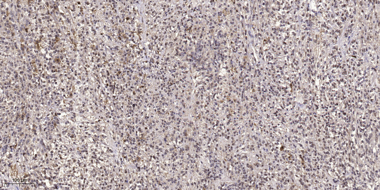 ATG14L Rabbit Polyclonal Antibody