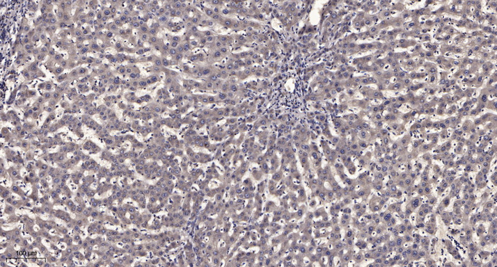 ATG13 Rabbit Polyclonal Antibody