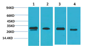 AMPKβ2 Polyclonal Antibody