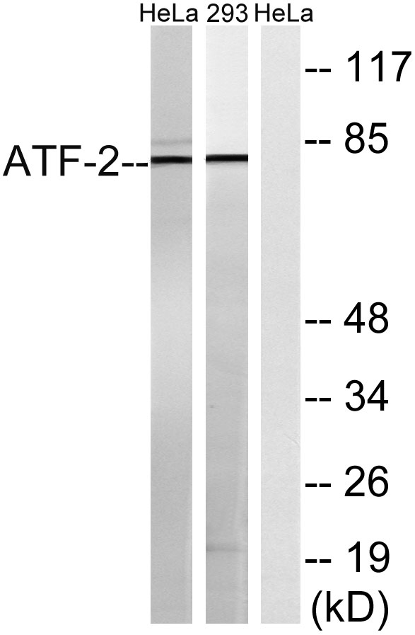 ATF-2 Polyclonal Antibody