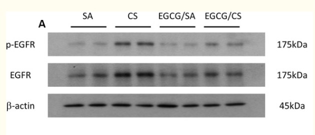 EGFR Polyclonal Antibody