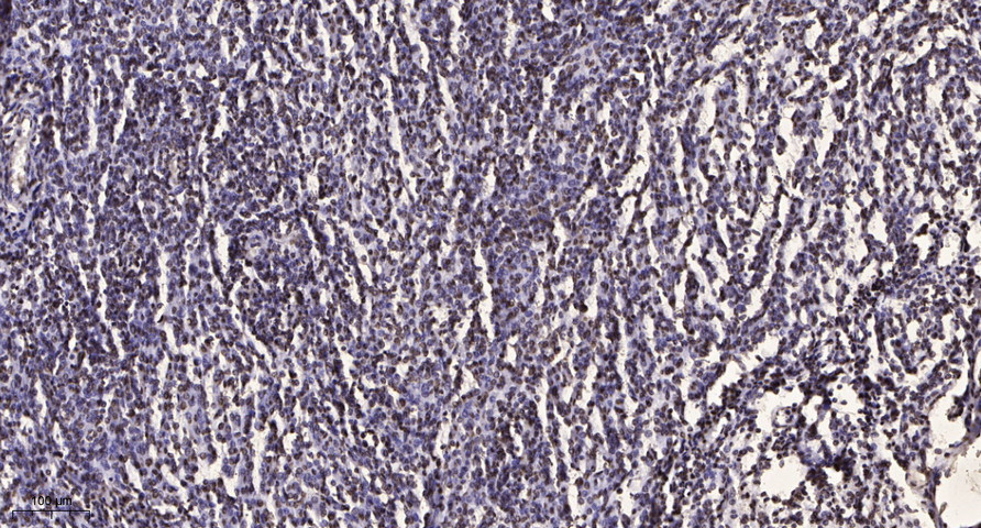 DFFB Polyclonal Antibody