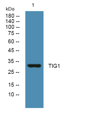 TIG1 Polyclonal Antibody