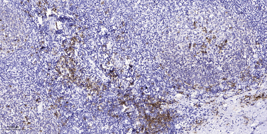 S26A5 Polyclonal Antibody