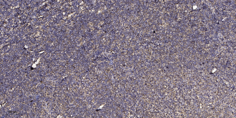 Adrenocorticotropin(ACTH) Polyclonal Antibody 