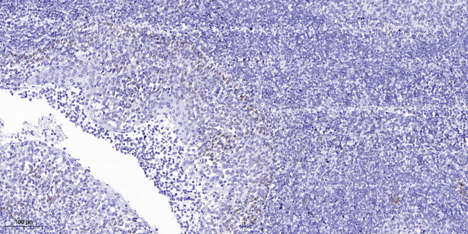 TAL1/TAL2  Polyclonal Antibody