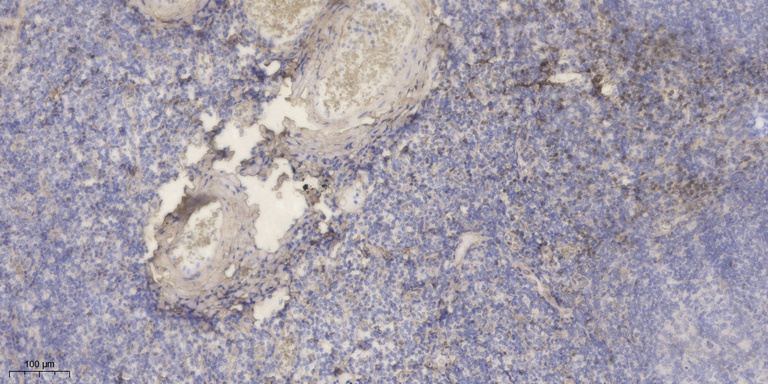 KLK15 Polyclonal Antibody