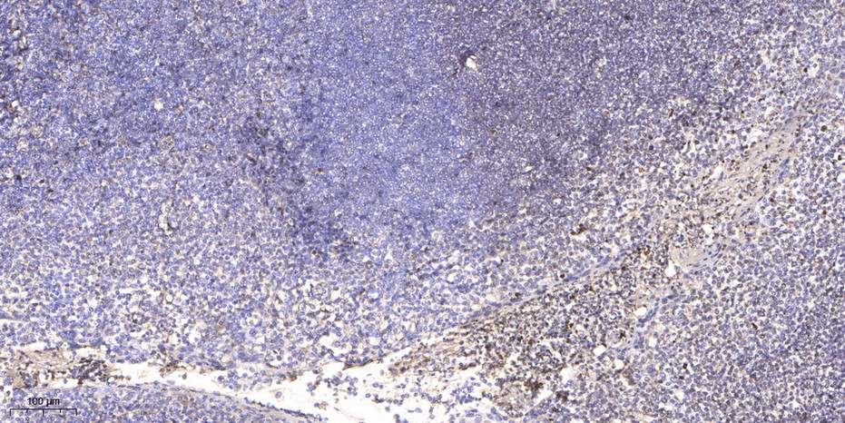 RAD1 Polyclonal Antibody