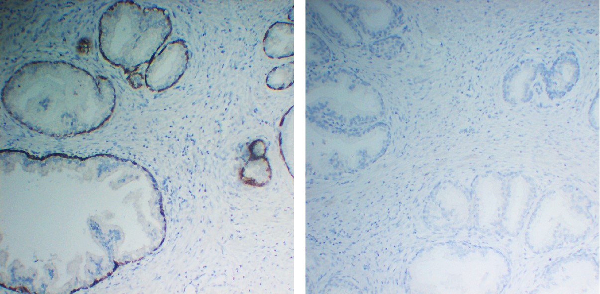 Negative Control for mouse IgG1, kappa Primary Antibody
