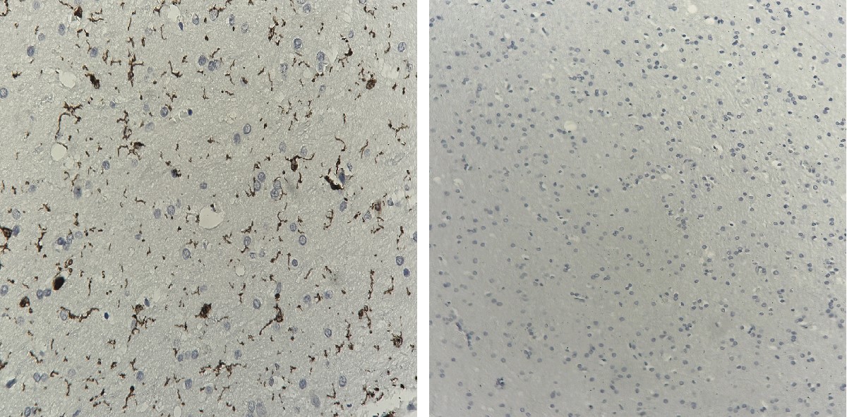Negative Control for mouse IgG Primary Antibody