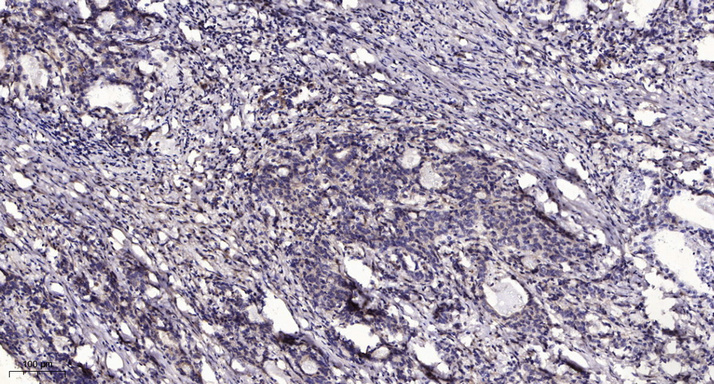 β-Tubulin Monoclonal Antibody(5G3), HRP Conjugated