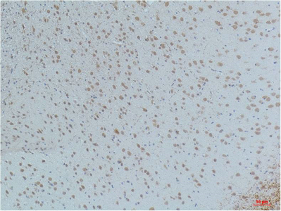 CaMKIIβ/γ/δ (Phospho Thr287) Monoclonal Antibody(4H2)