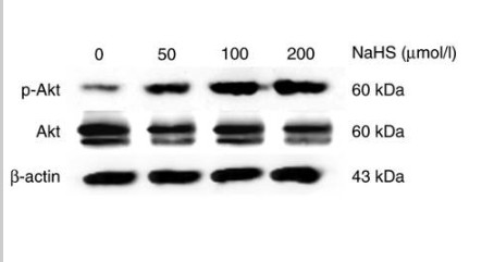 Phospho Akt (S473) mouse Monoclonal Antibody(7F9)