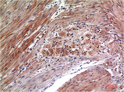 Phospho ERK 1/2 (Y222/205)Mouse Monoclonal Antibody(4G3)
